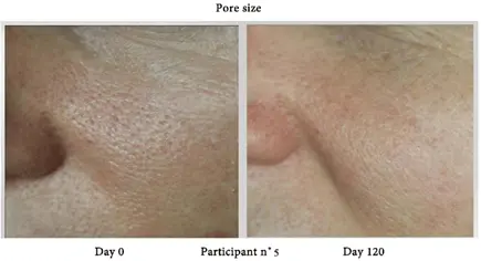 Before and After