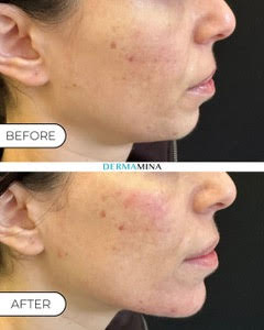 Before and After