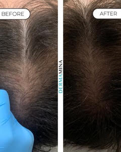 Before and After