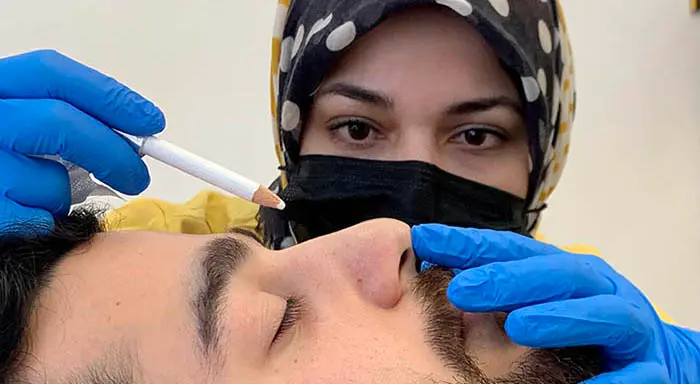 Nose filler results