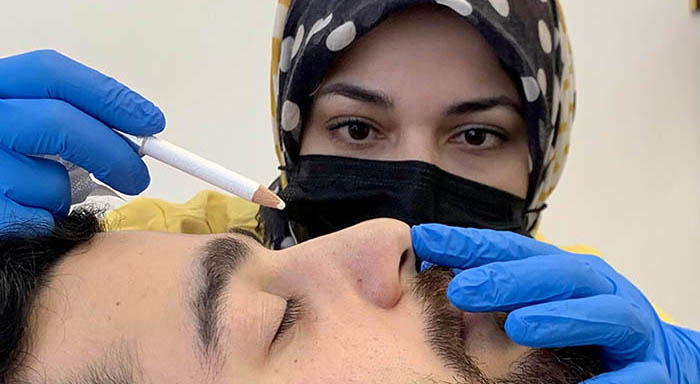 Nose Fillers London