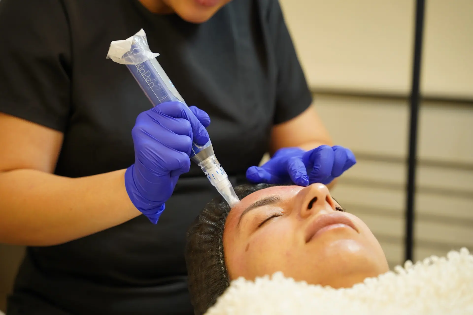 SkinPen Microneedling London at Dermamina London
